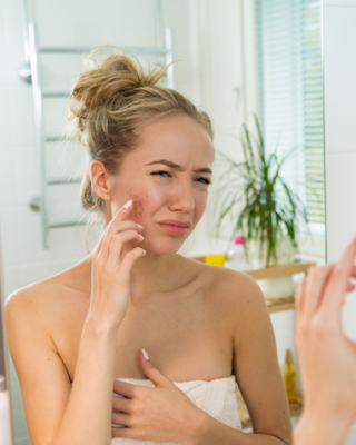 Ein Blick ins Innere der Akne